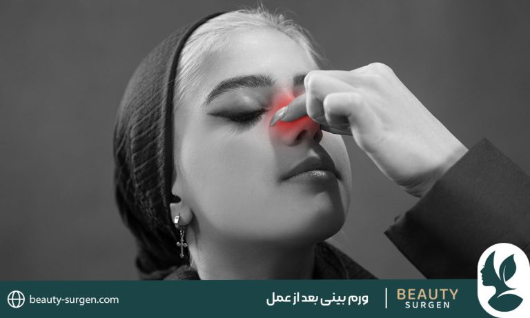 ورم بینی بعد از عمل